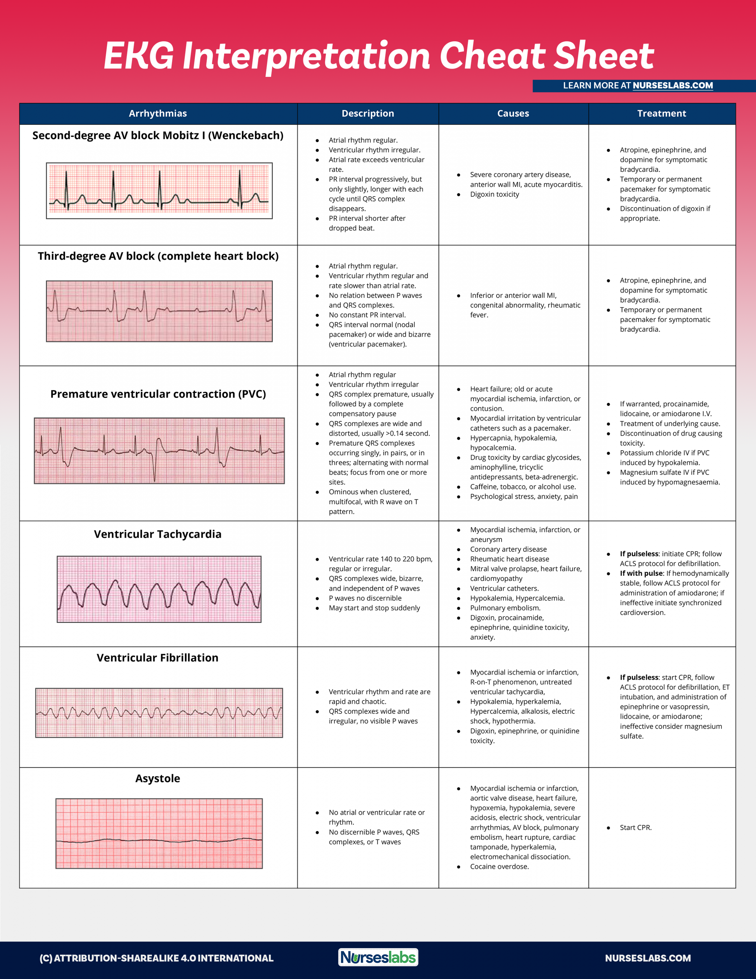 EKG Interpretation Cheat Sheet & Heart Arrhythmias Guide ( Update)